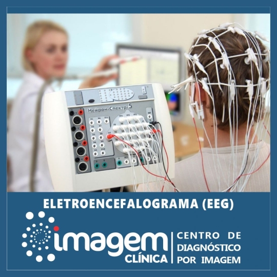 eletroencefalograma(1920 x 1080 px)