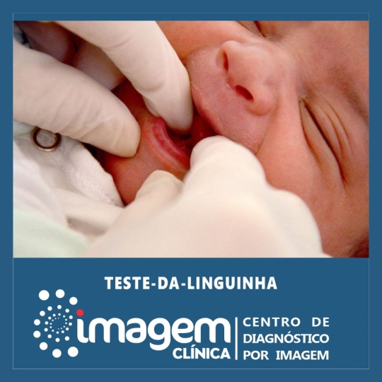 teste linguinha (1920 x 1080 px)